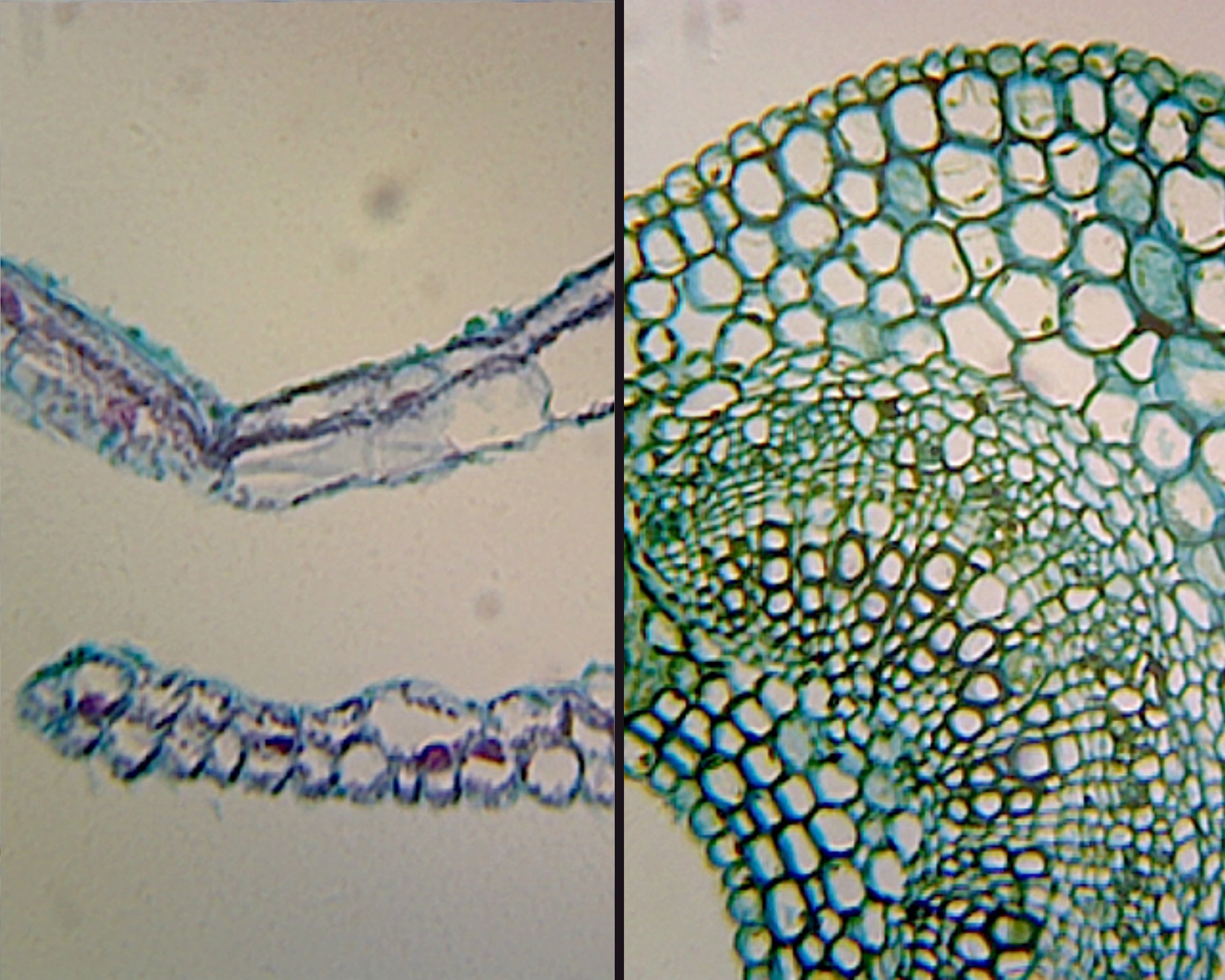 Gsc International Angiosperm Leaf; Air (Ligustrum) And Water (Elodea ...