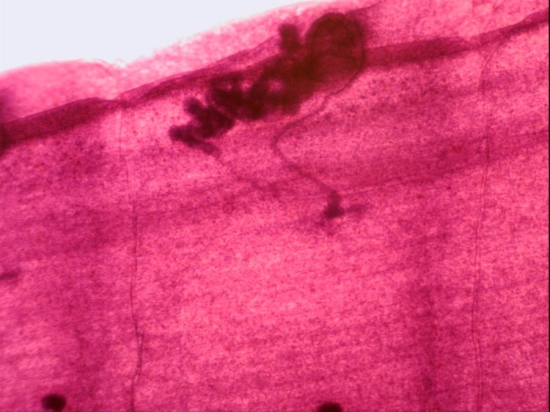 Gsc International Taenia Immature Proglottid From Cow Or Sheep Gsc International Taenia Immature Proglottid From Cow Or Sheep