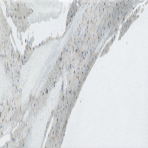 Amala Cloud Porcelain Tile - Glossy & Matte - 3" X 12"