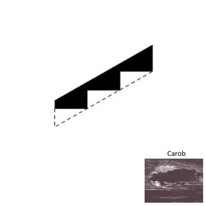 Marbleized Carob Rubber Stringers - Smooth